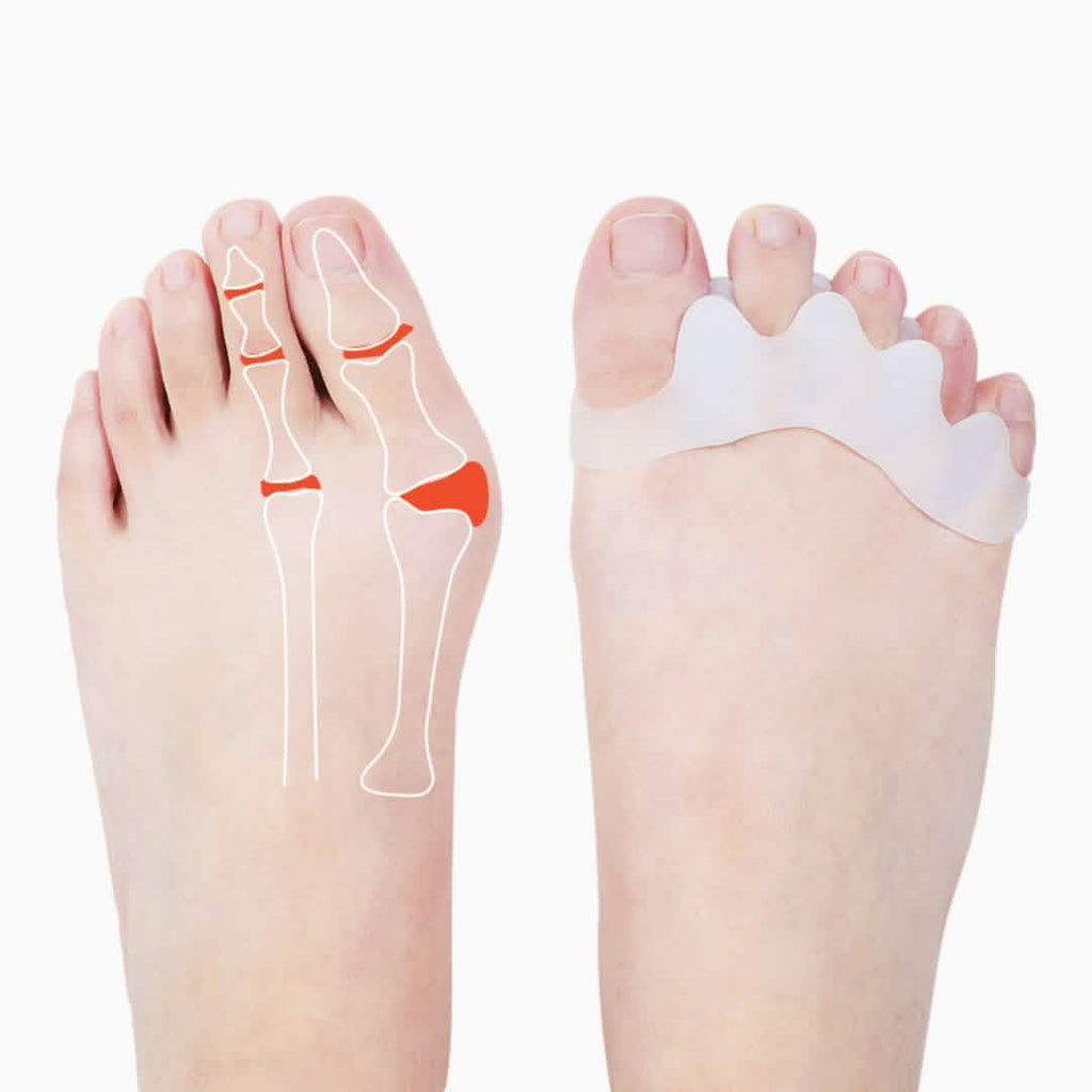 4-Pack: Toe Separator Bunion Toe Spacer for Overlapping Hammer Toe