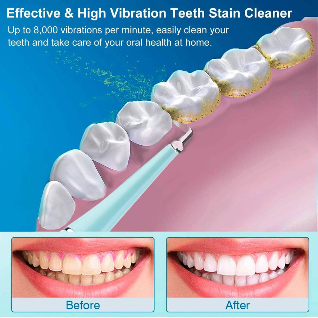 Electric Tartar Remover For Teeth