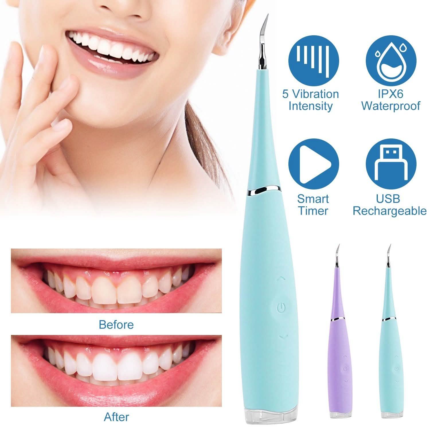 Electric Tartar Remover For Teeth