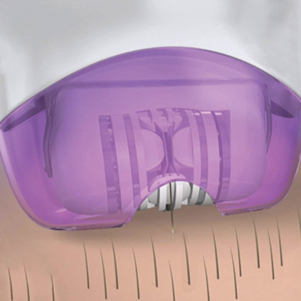Epi Smooth Removes Hair At The Root