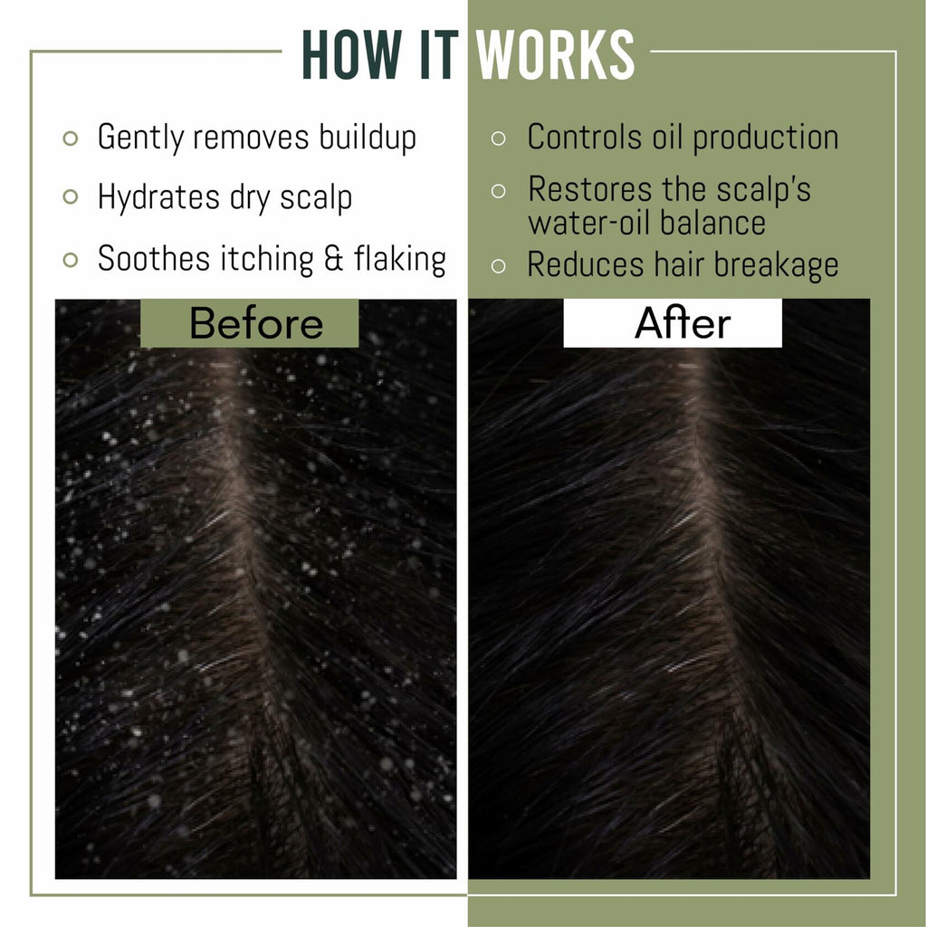 MagiForet Anti-Dandruff Shampoo & Conditioner Set 2x500ml Dry Flaky Scalp