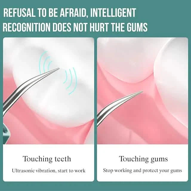 Visual Ultrasonic Teeth Cleaner